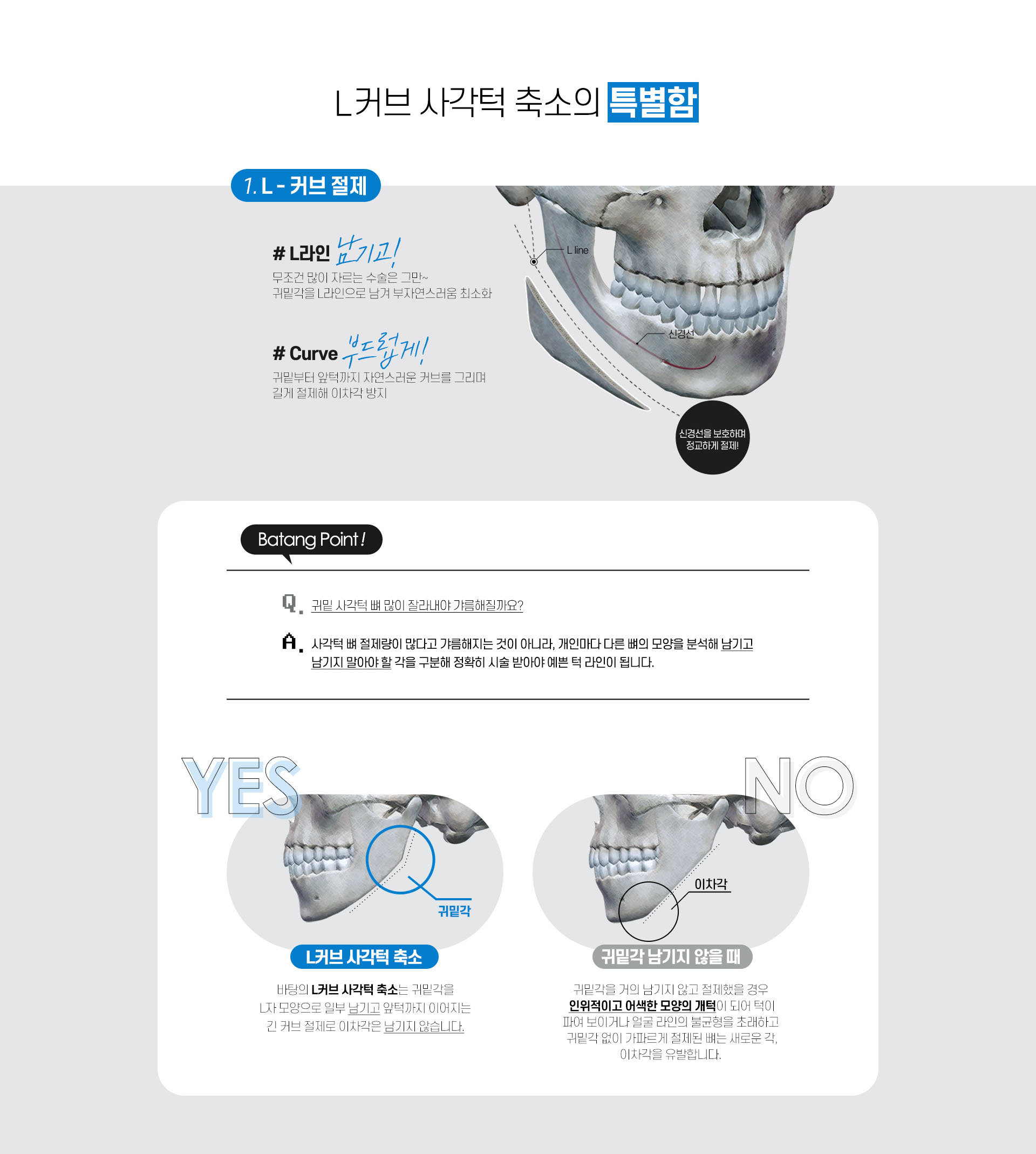 L커브 사각턱축소의 특별함