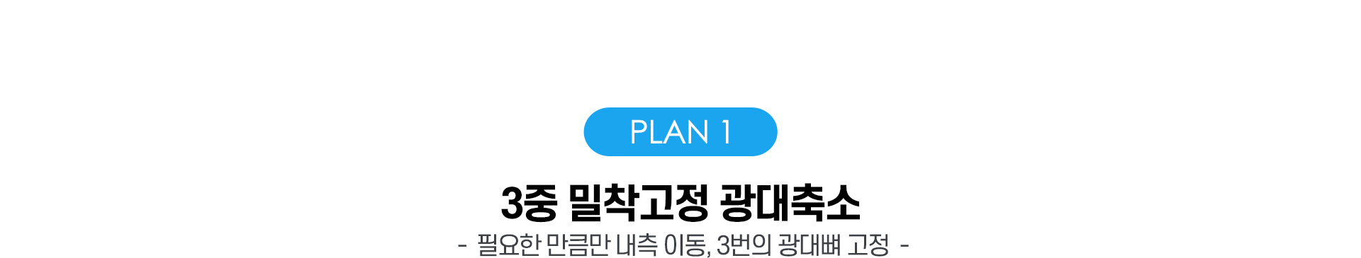 안면윤곽