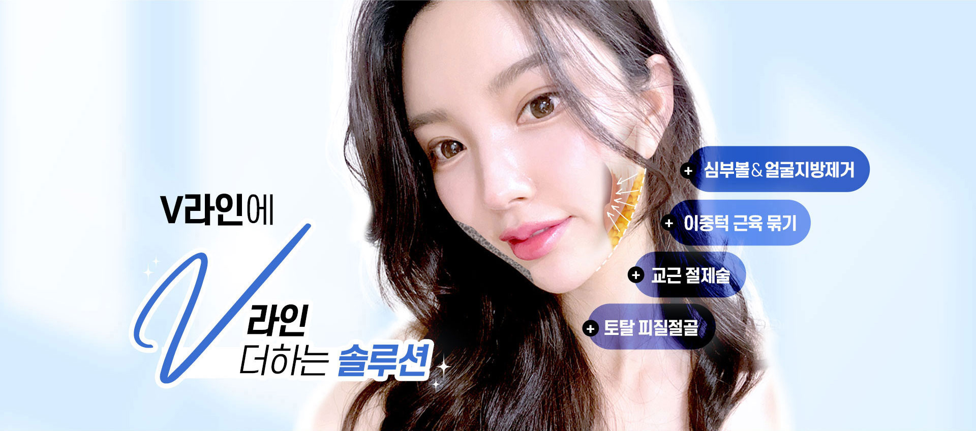 V라인에 V라인 더하는 솔루션