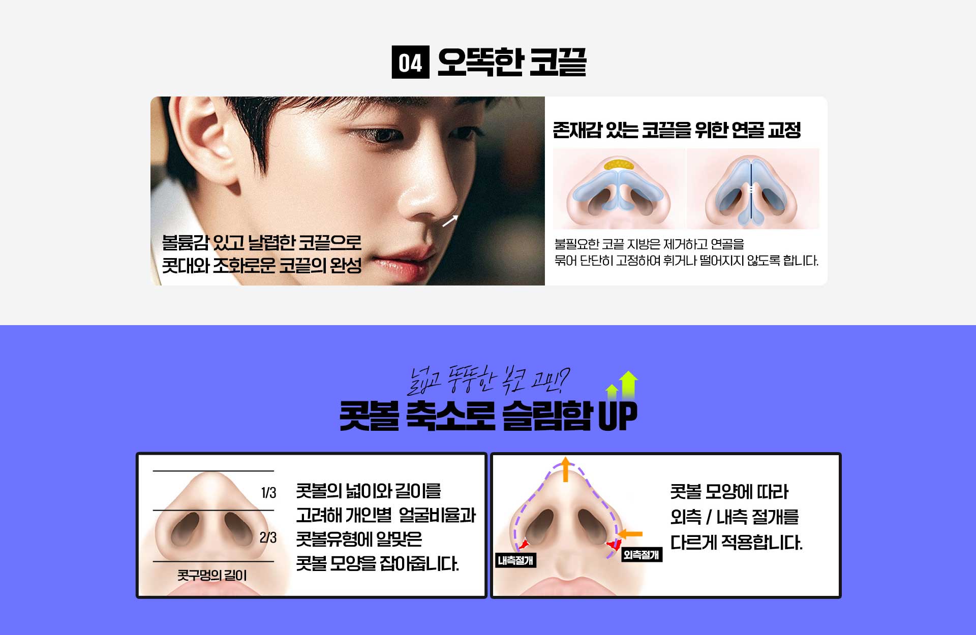 바탕남자코성형